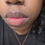 User submitted media 1 of 3